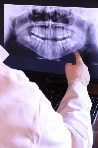 Best Emergency Denture Repair in Everett, WA